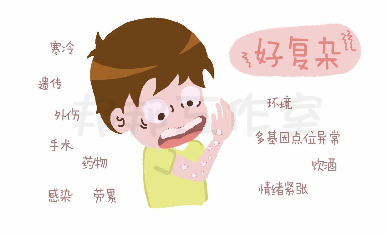 银屑病到底有多复杂？其实，可以简单点的- 知乎