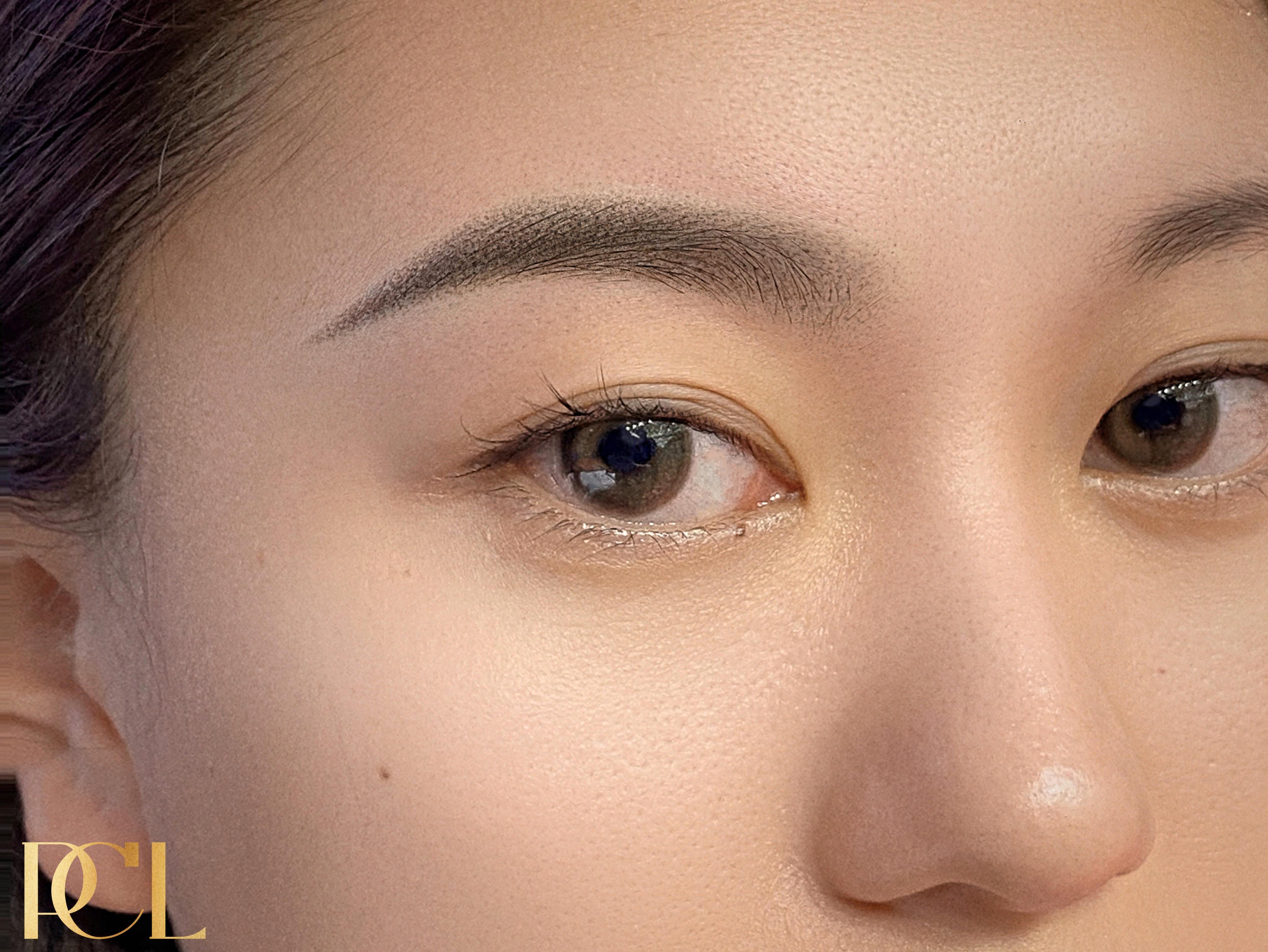 雾眉怎样操作不结痂