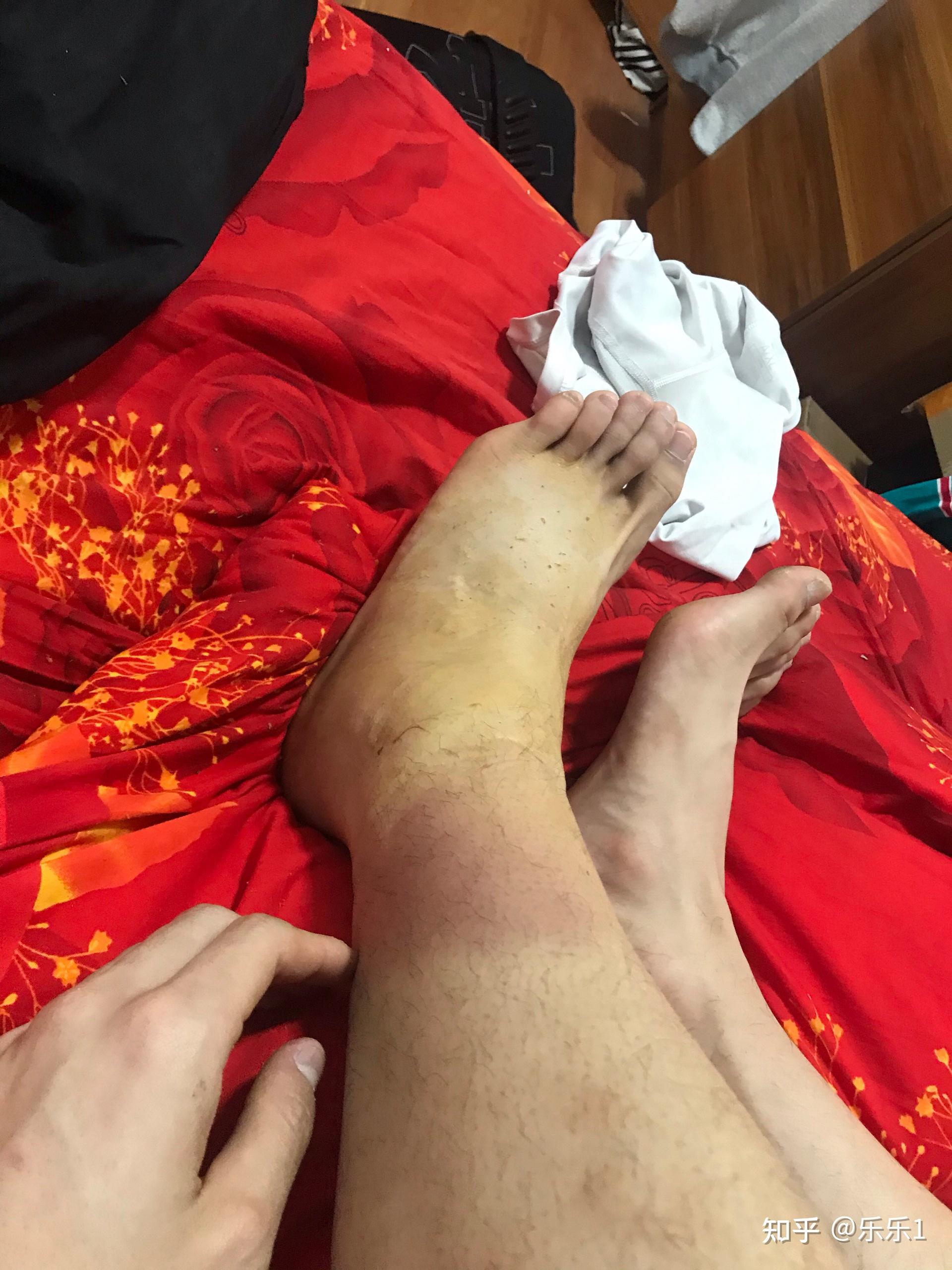 我是个体育生,我受伤了,情绪很低沉怎么办? - 知乎