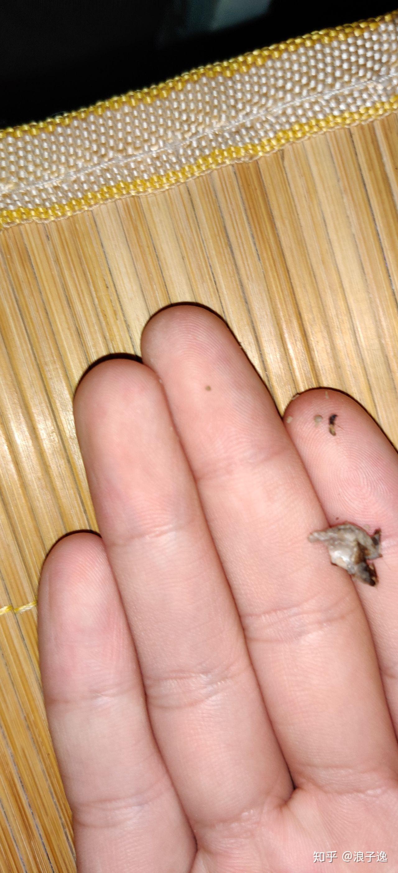 肚脐眼里面的灰可以抠吗?抠了肚子会进风,人会生病之类的说法正确吗?