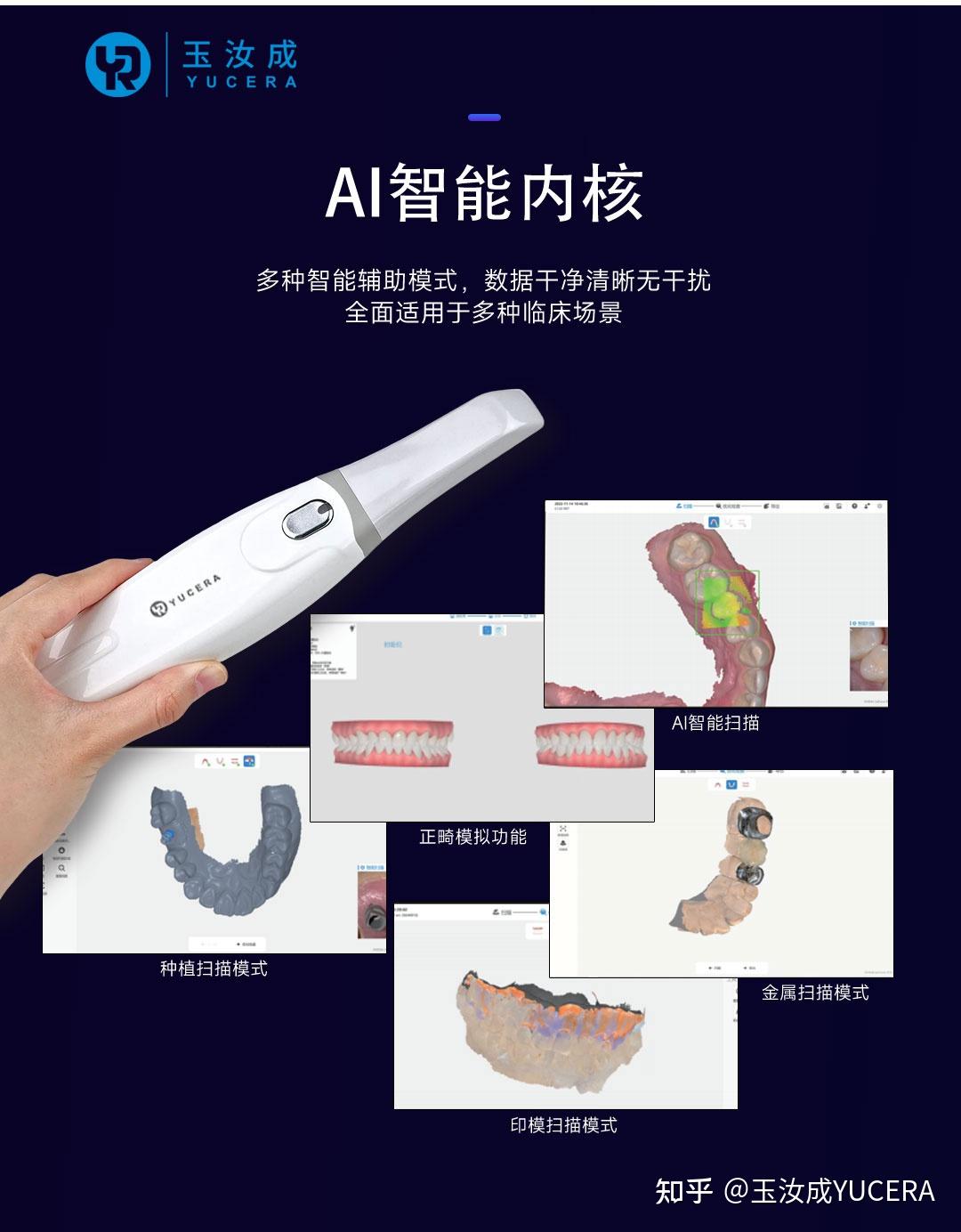 口扫技术为何在牙科修复和种植中遇冷?深层原因与突破路径分析 - 知乎