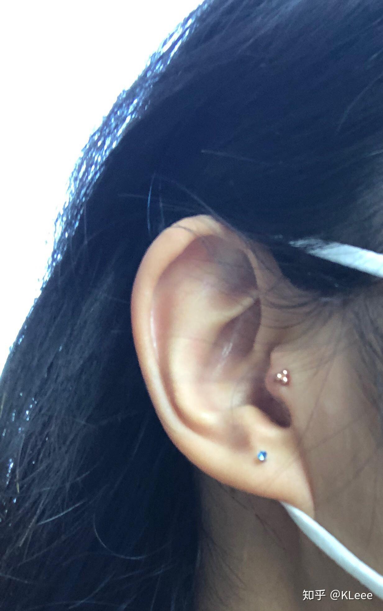 耳屏打耳洞有多痛? - 知乎