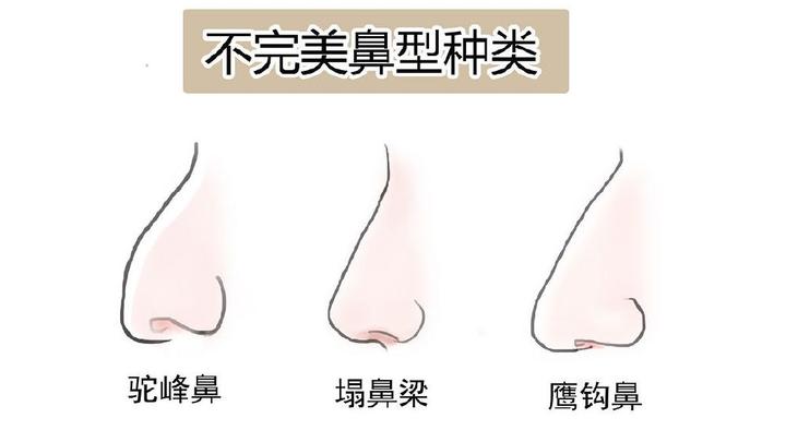 什么是不完美的鼻型 - 知乎