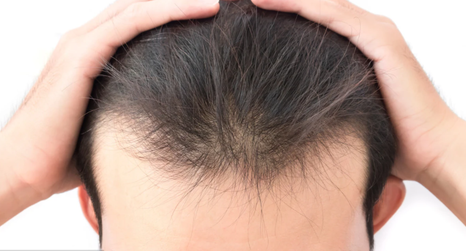 头发细软都是小绒毛,如何养发才能恢复啊? - 知乎