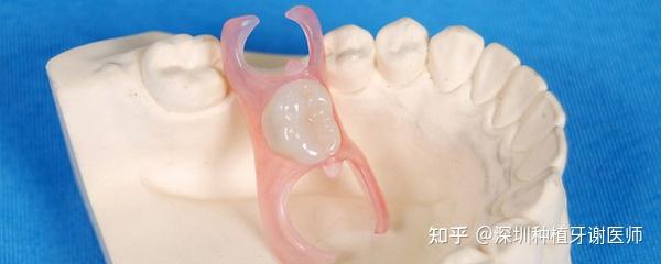 请问活动假牙的纯钛牙托多少钱