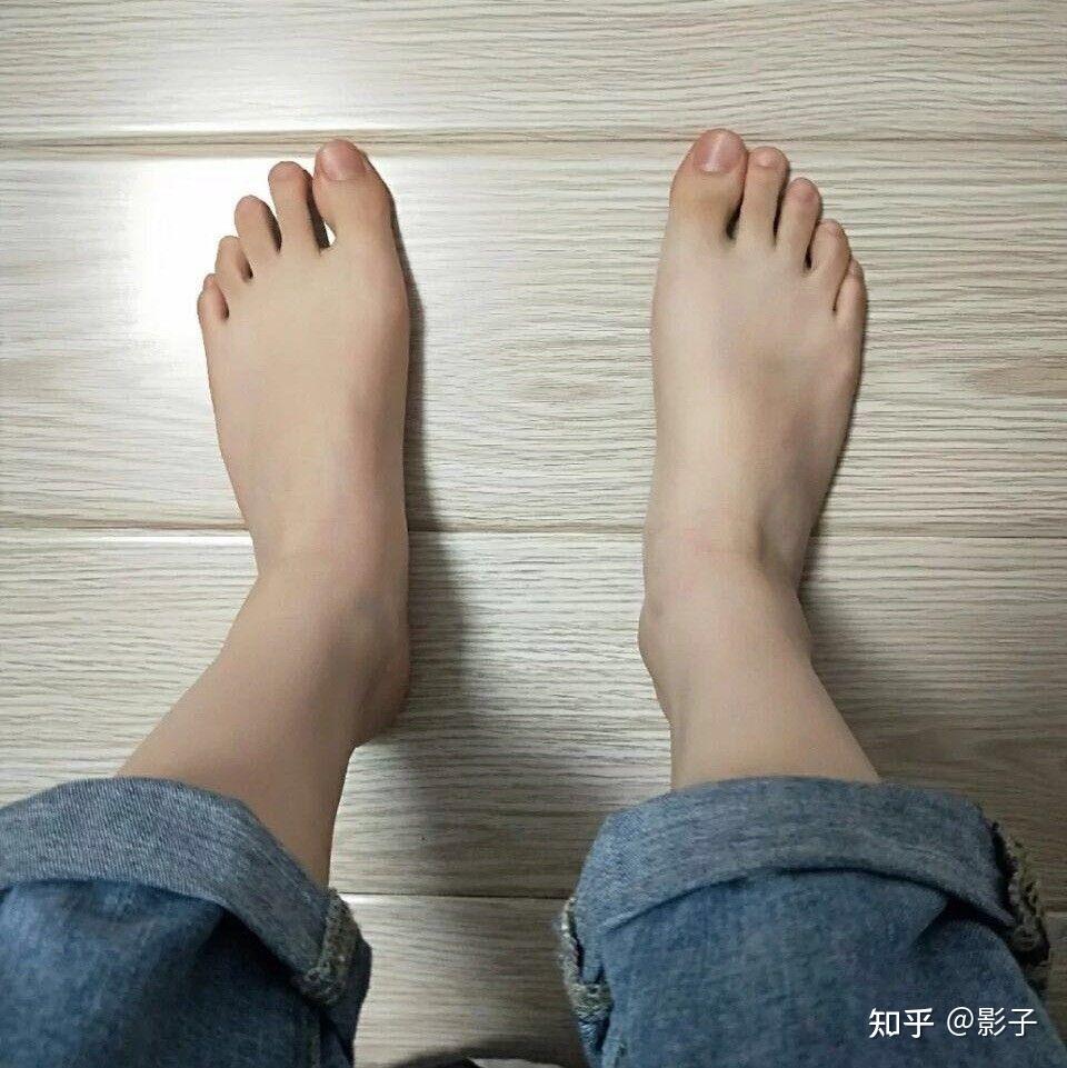 女生难看的脚图片