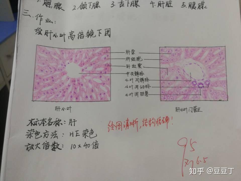 高倍镜下肝小叶和门管区红蓝铅笔手绘图? - 知乎