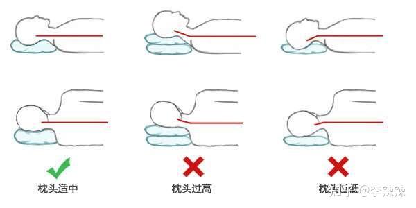 颈椎枕正确枕法图片图片