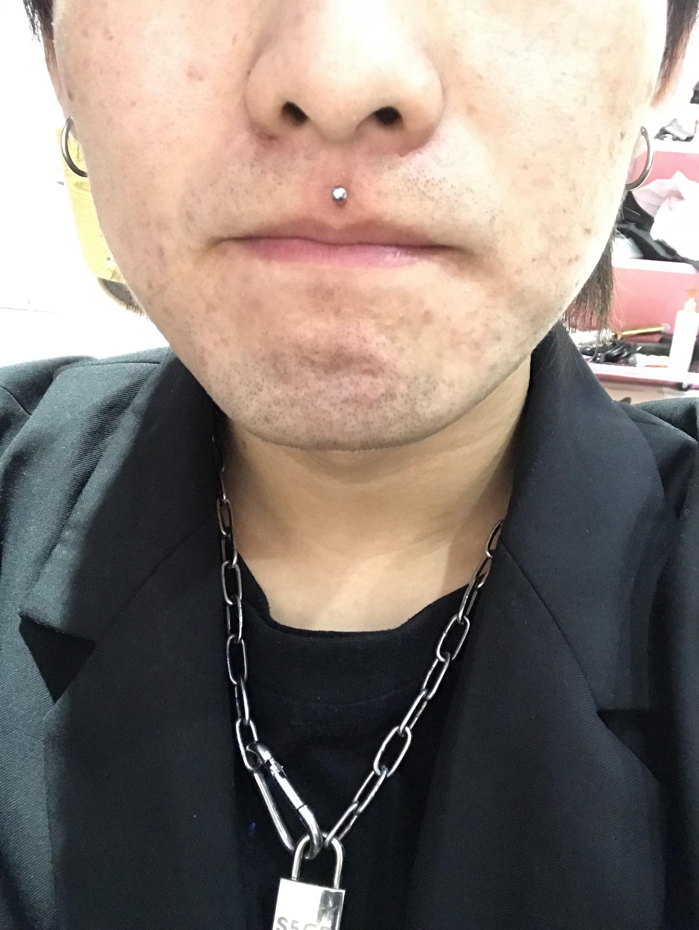 我想看看唇钉摘下后是什么样子的