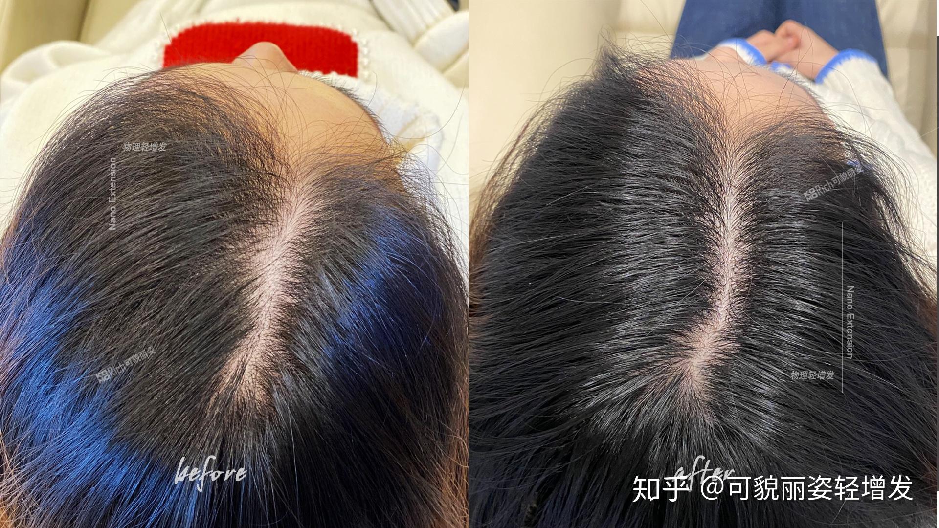 请问这个发缝正常吗? - 知乎