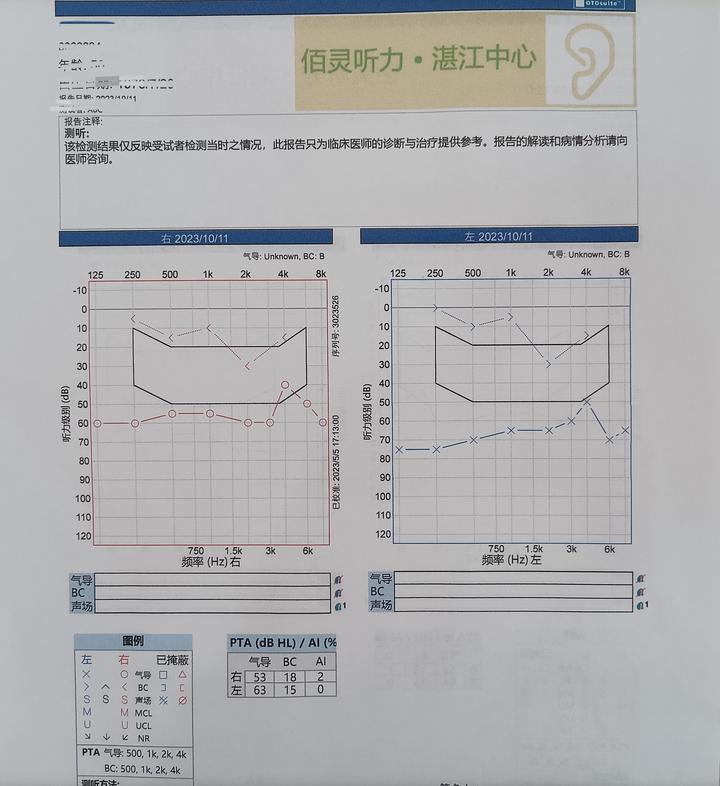 今日听力案例分析 - 知乎