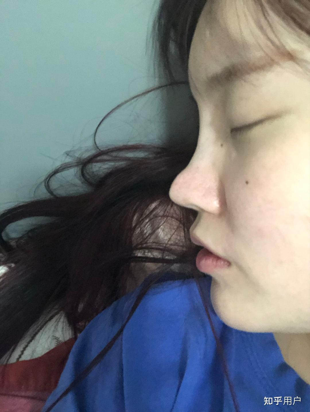 还有艺星的张龙鼻修复哪一位更适合做自然款的? - 知乎