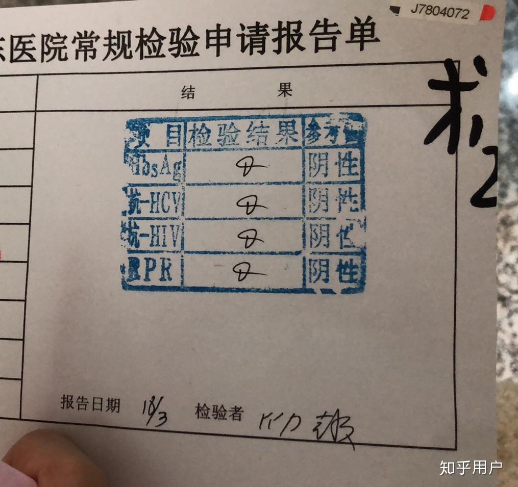 检查艾滋病,得知结果是阴性后是怎样一种体验? - 知乎