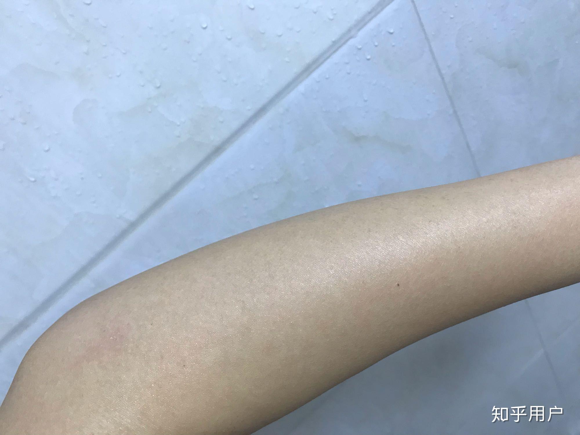 怎么样才能让体毛变少？ - 知乎