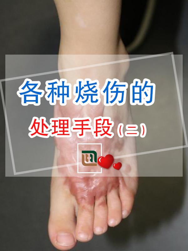 各种烧伤的处理手段 - 知乎