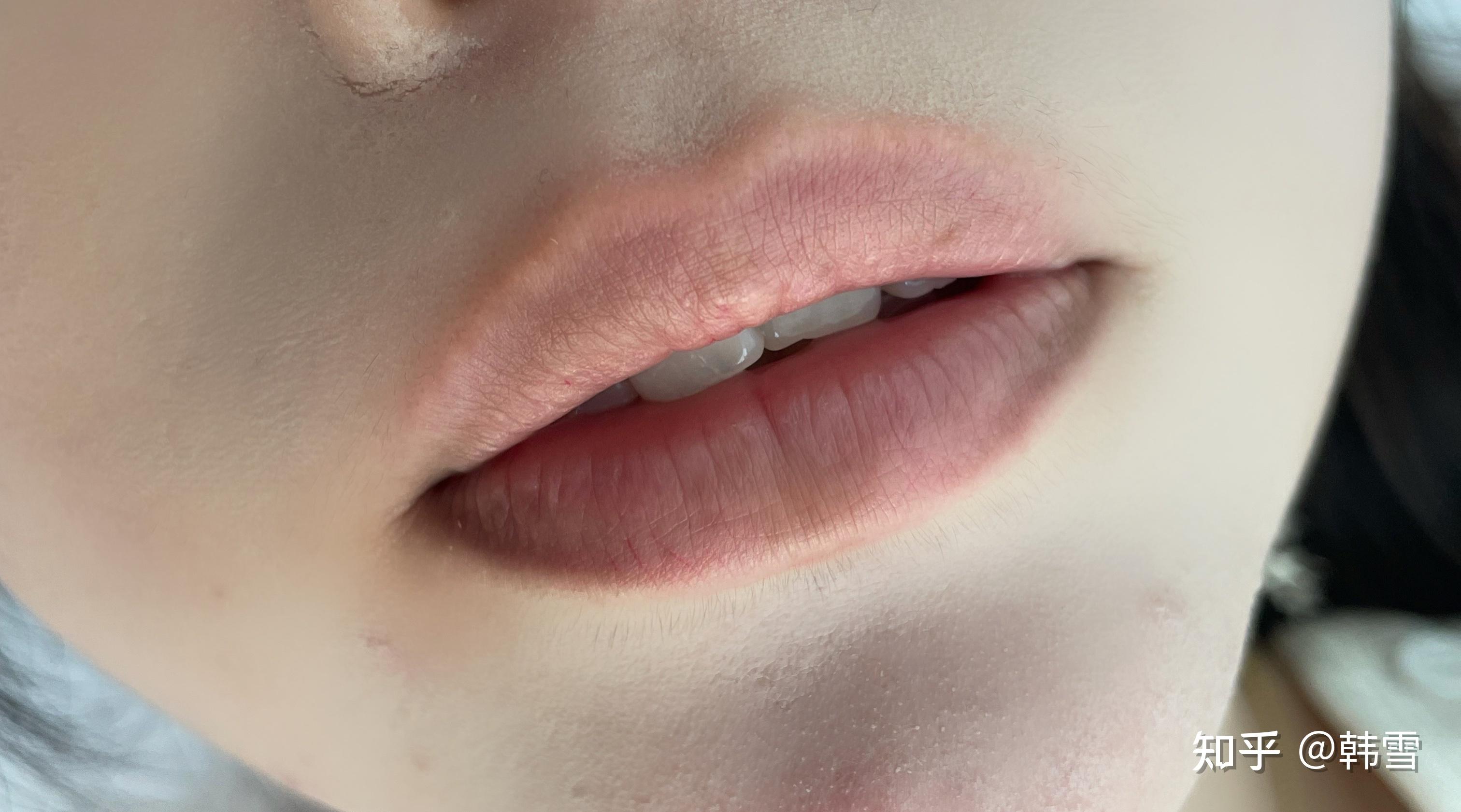嘴唇变乌? - 知乎