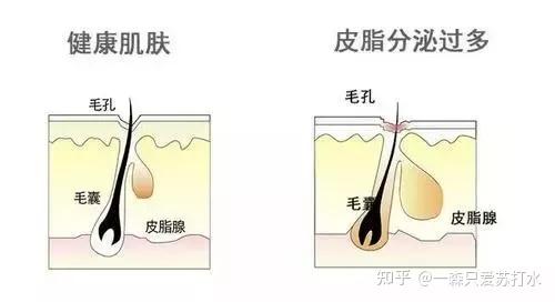 油皮和混油皮怎样区分呀? - 知乎