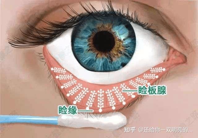 睑板腺按摩到底做了哪些按摩动作了为什么不叫做睑板腺清洁或者其它