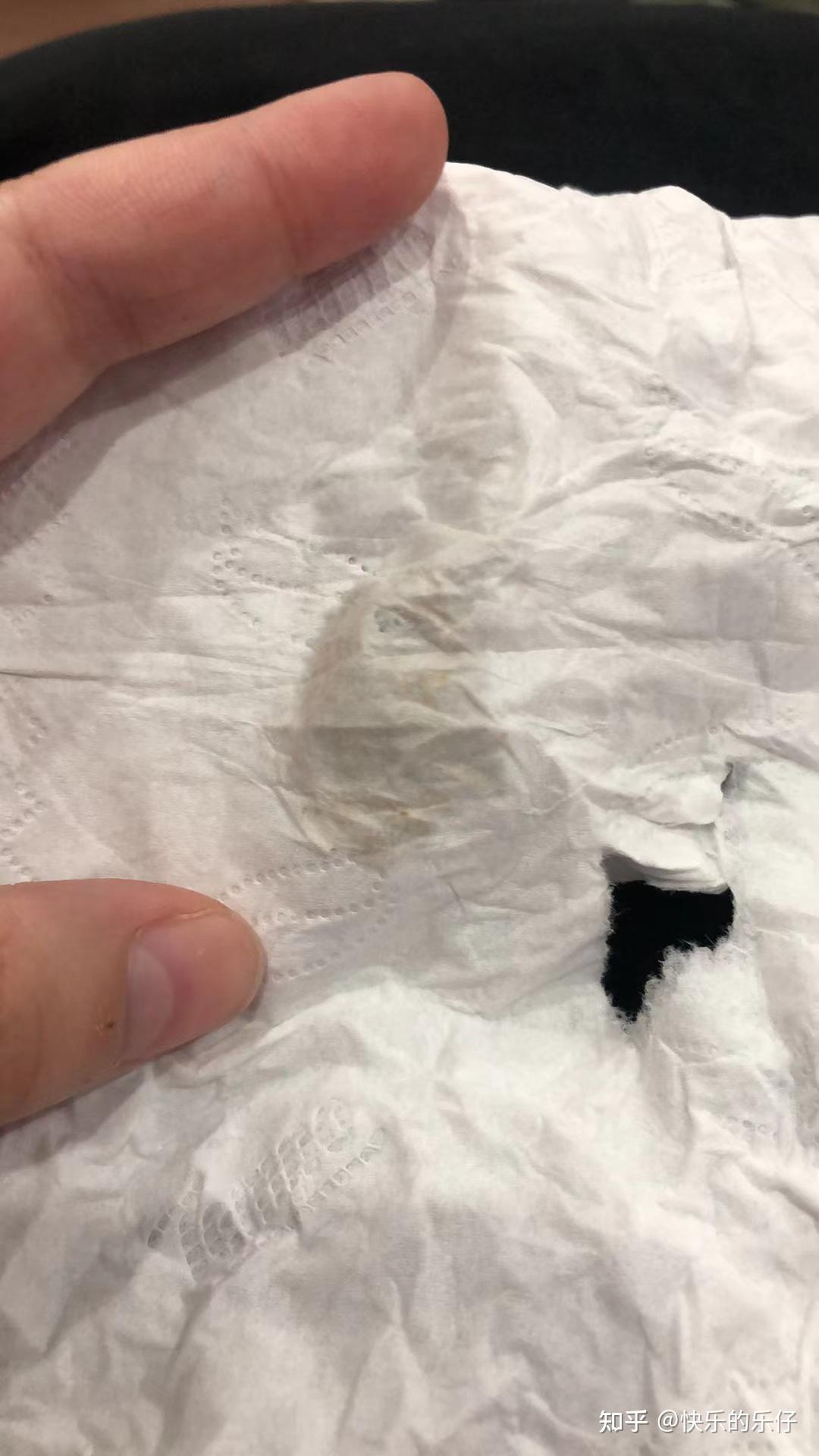 人流后月经量少颜色黑