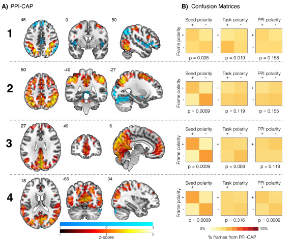 NeuroImage：任务态fMRI时间分辨的有效连接：共激活模式的心理生理交互