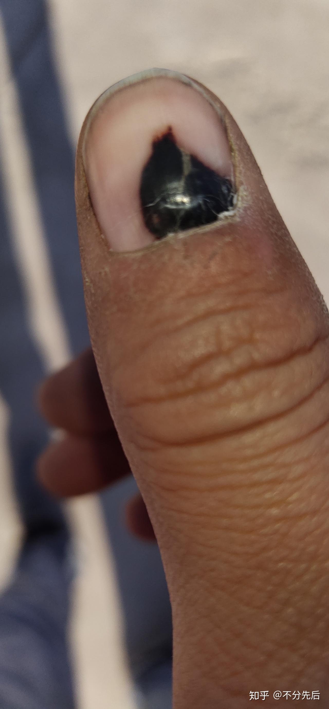 玩无架弹弓怎么不打手