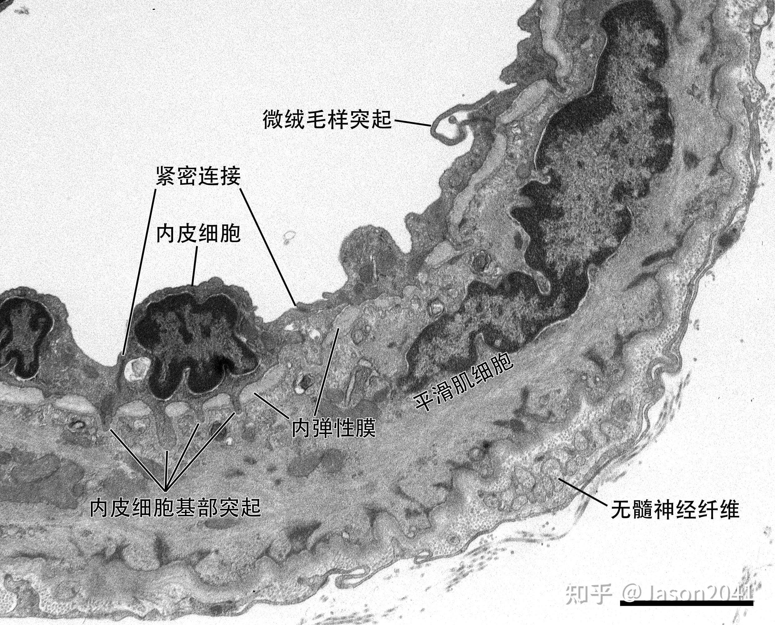 动脉或静脉壁通常可分为哪几层结构? - 知乎