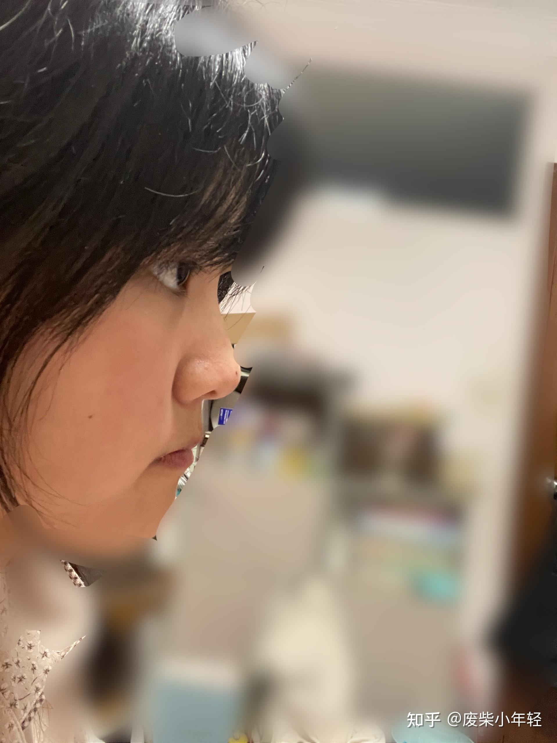 有一个超级扁平的侧脸是一种什么样的体验