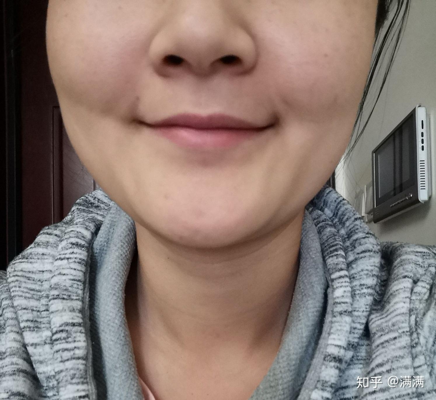才20岁,下半张脸特别臃肿显老怎么办? - 知乎