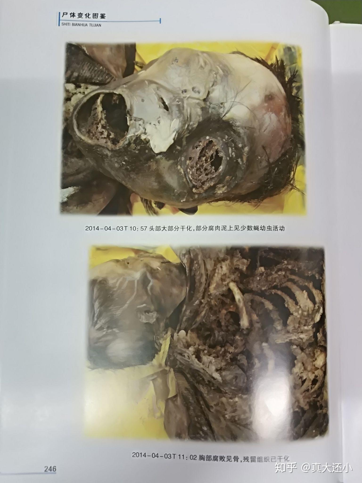 人体腐烂过程变化图册图片