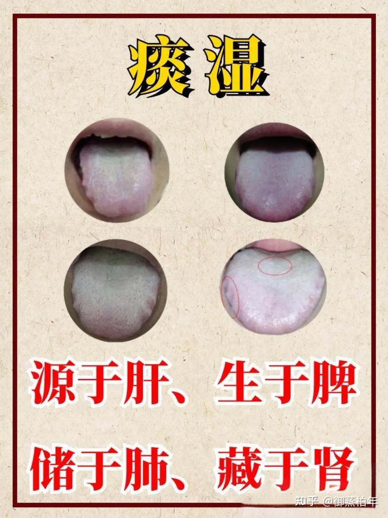 【古酒熏蒸】与痰湿 - 知乎