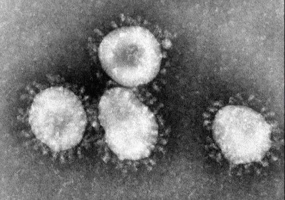 病原微生物学基本原理决定了新冠病毒在人间的持续存在已无法避免- 知乎