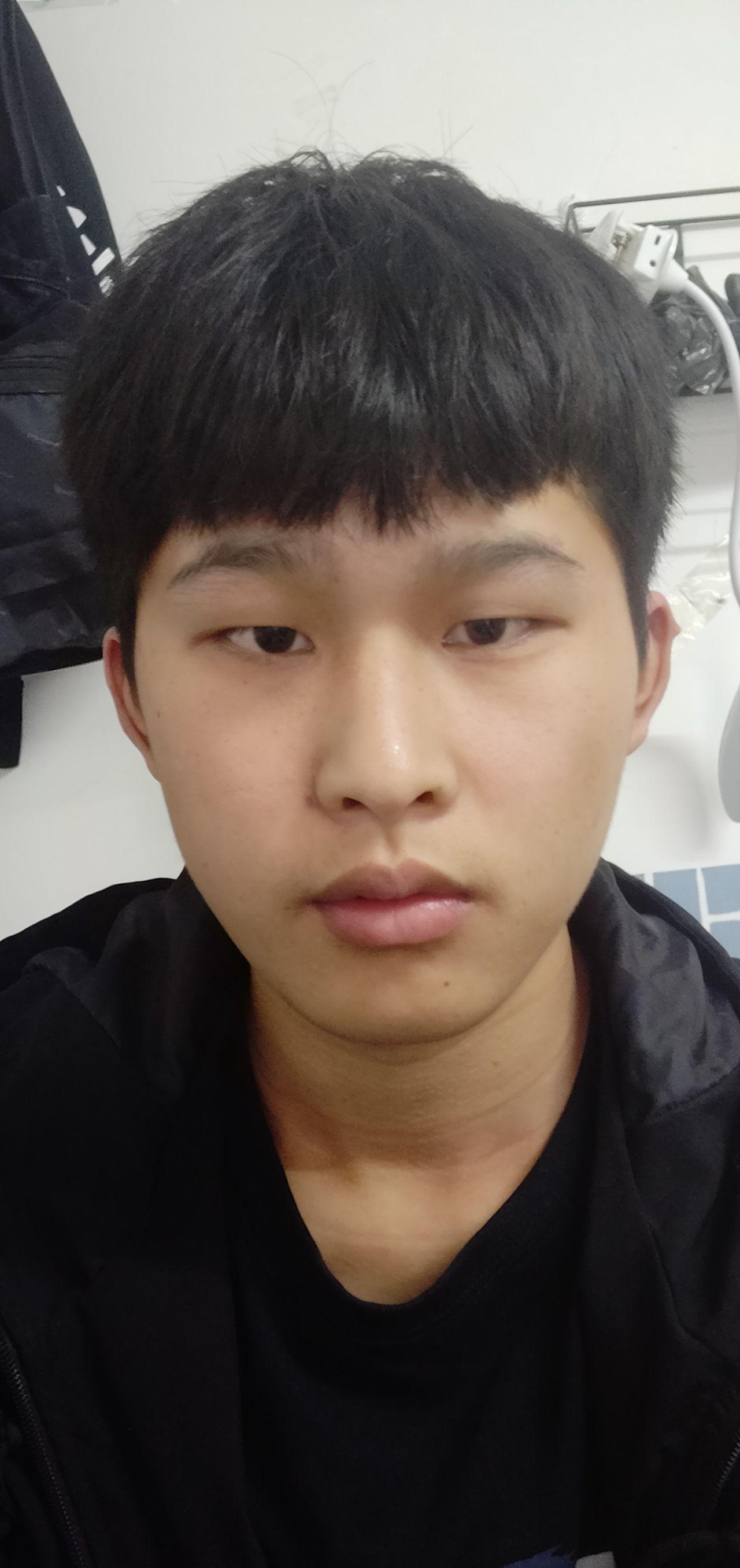 厚嘴唇塌鼻子单眼皮的男生还有救吗