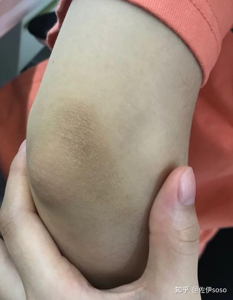 有哪些好用的身体磨砂膏值得推荐? - 知乎