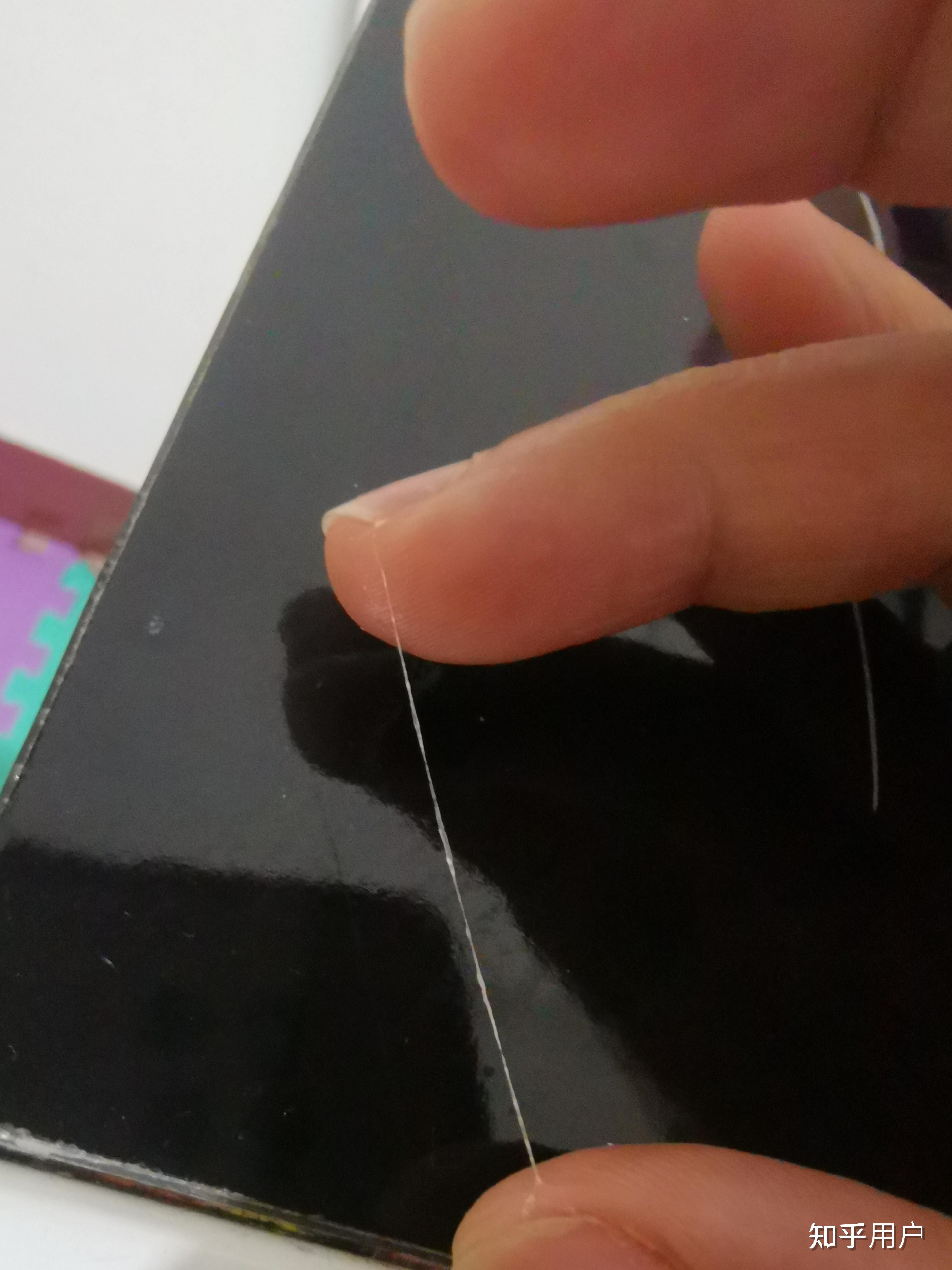 想问一下大家有没有眼睛里总是能抠出白色丝状物