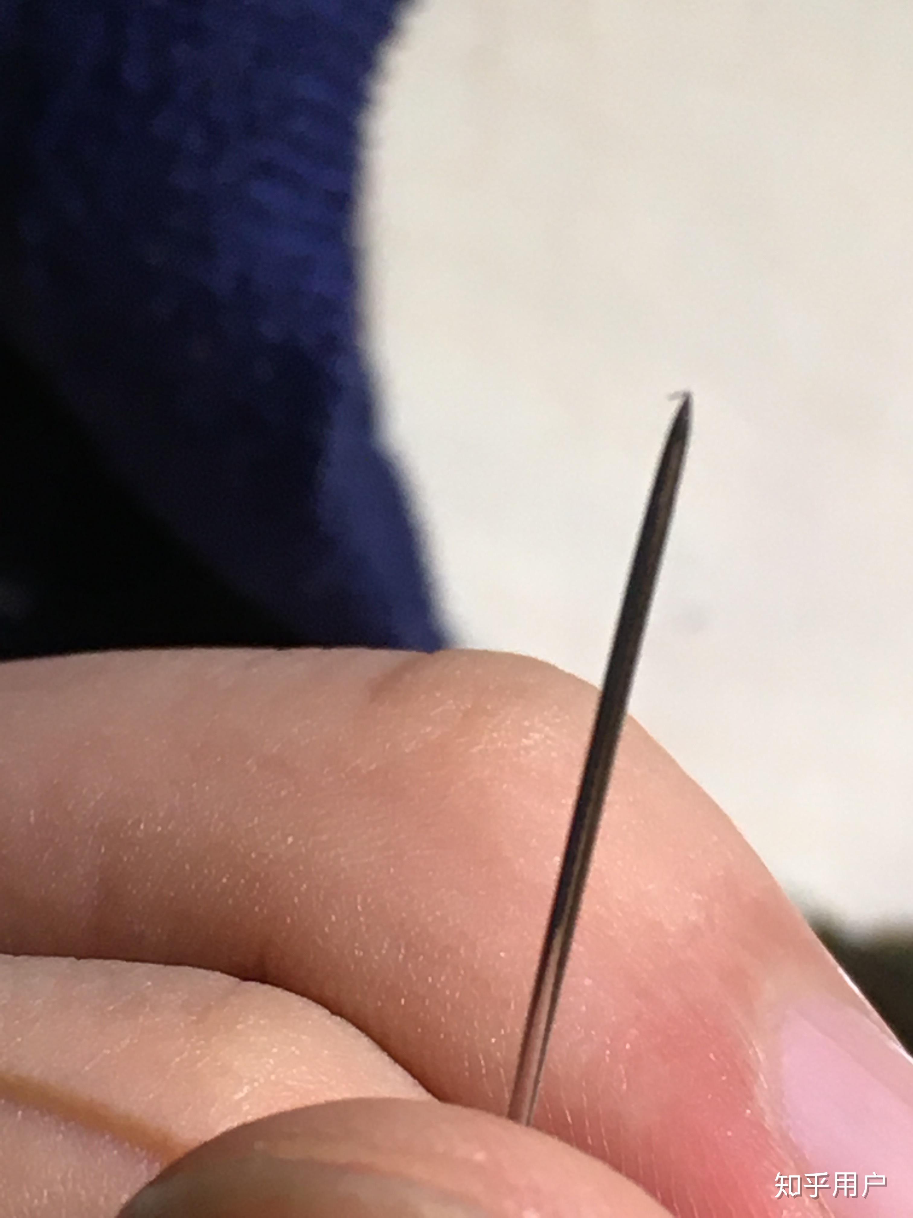 一个头发碴子扎进手指怎么办? - 知乎