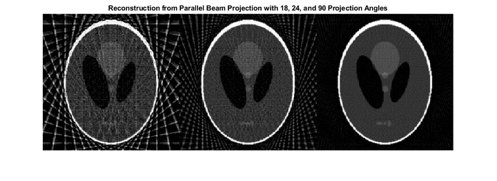 Matlab Image Projection MATLAB图像处理:14:从投影数据重建图像 - 知乎