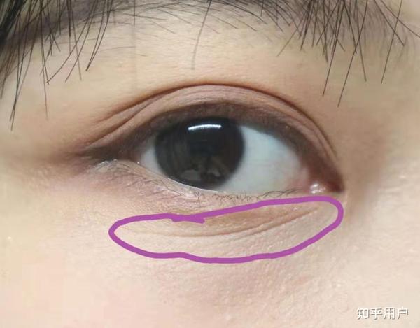 还是揉眼睛的原因,小细纹也爬上了眼角,这次真成老阿姨了!