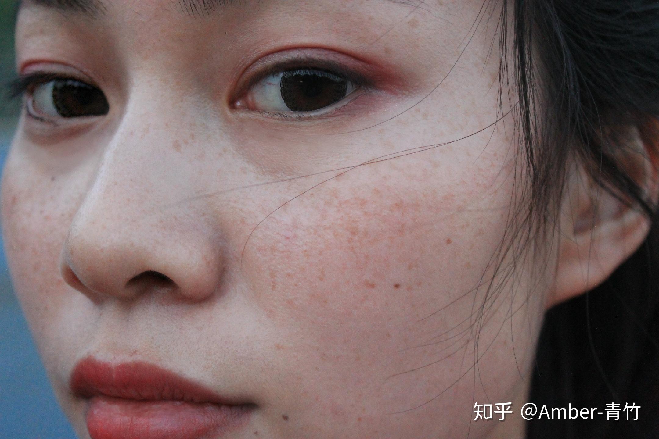 各位觉得长雀斑的女孩子怎么样呀