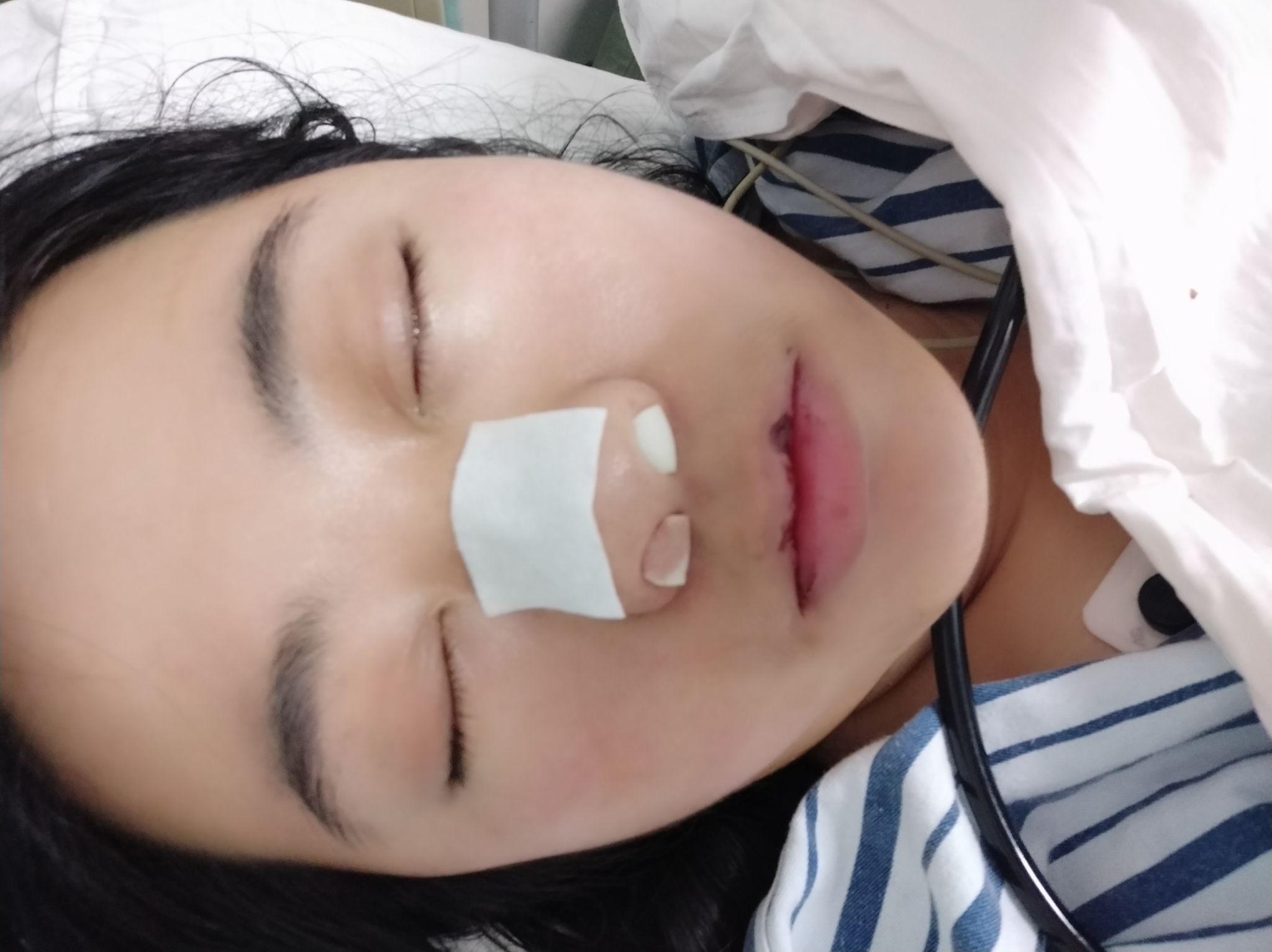 鼻窦炎手术的感觉如何,手术前和手术后你有哪些想分享的? - 知乎