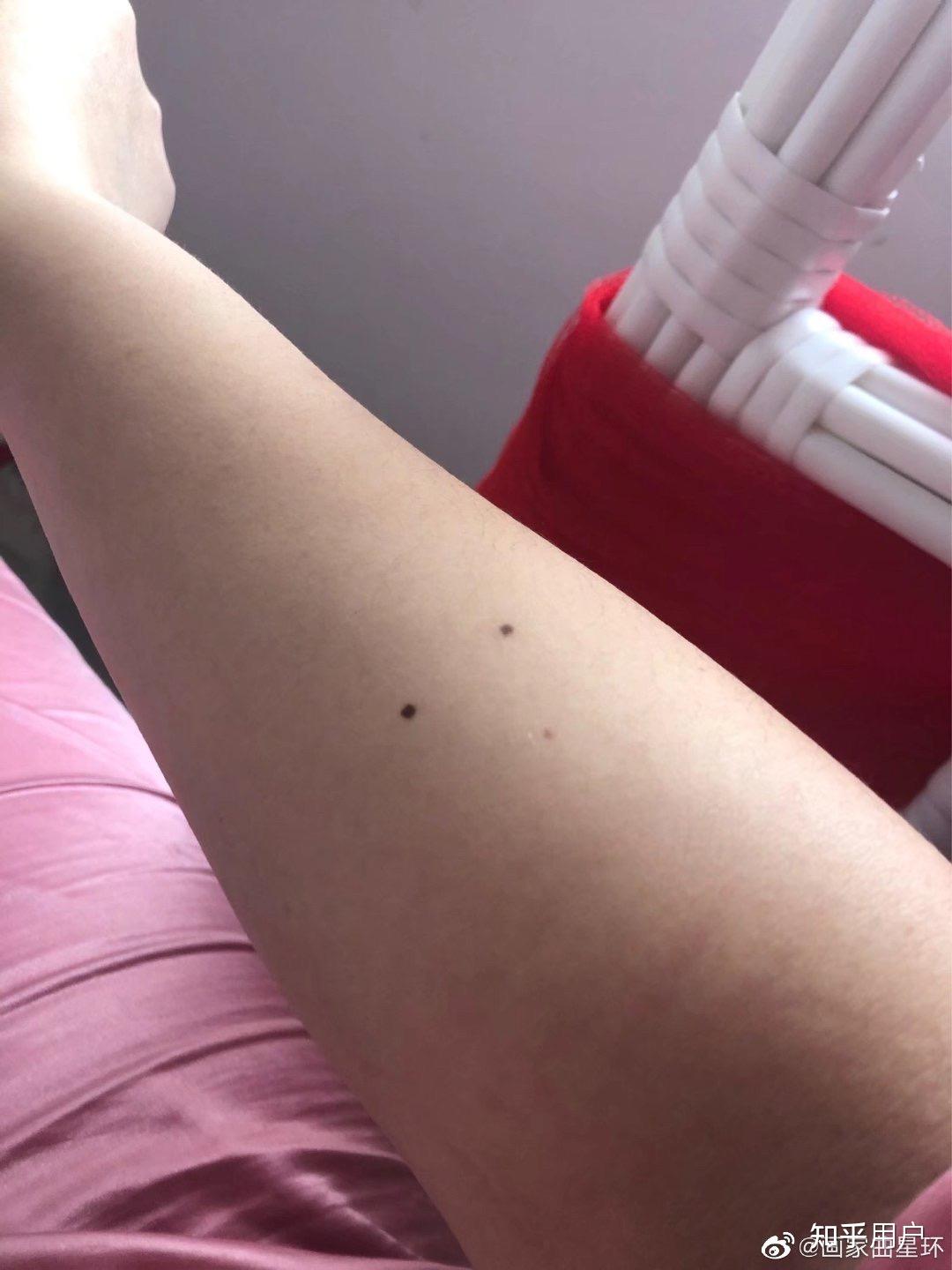 画家曲星环右手臂上是不是有三颗痣能连成等腰三角形? - 知乎