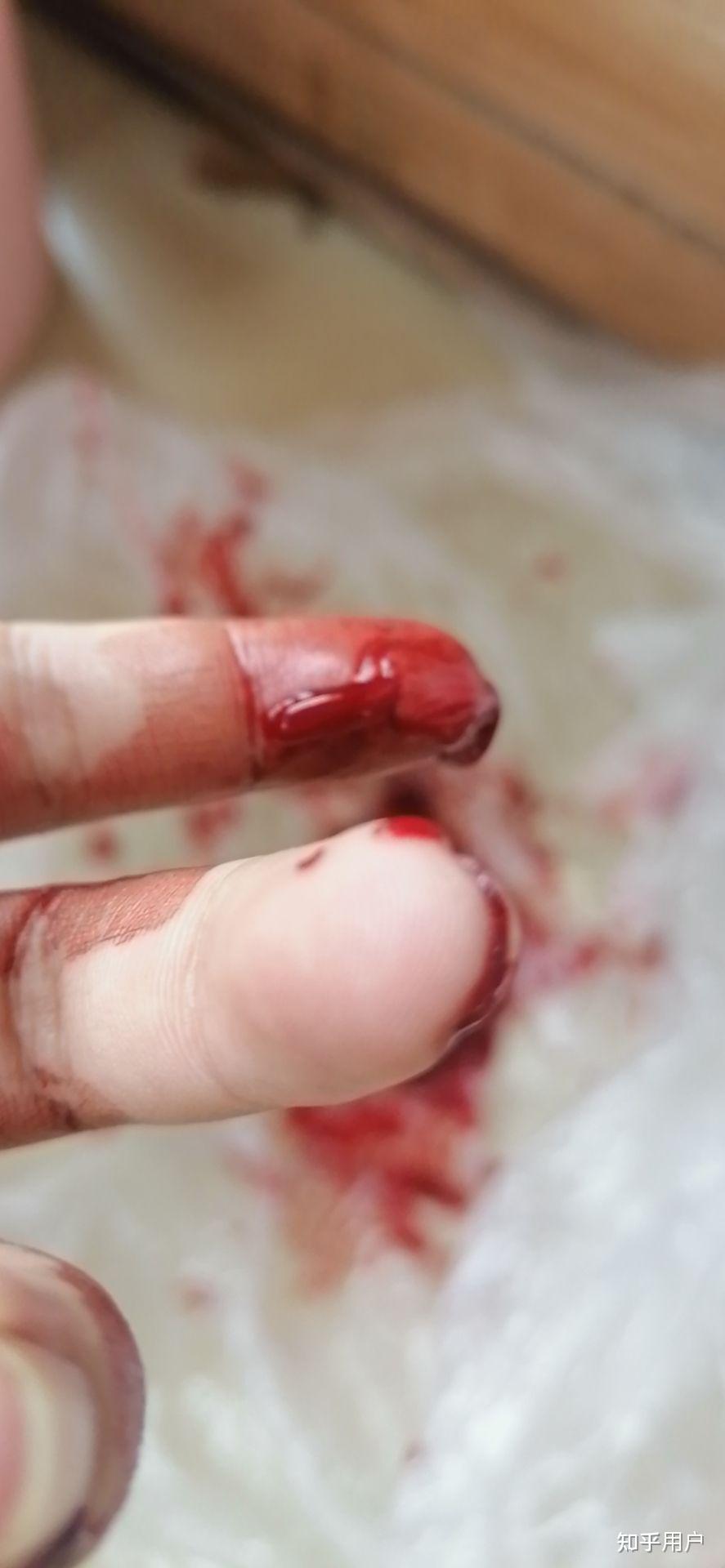 仓鼠咬人屡教不改可以扔了吗