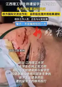 江西理工大学留学生打人事件，打的是谁的脸