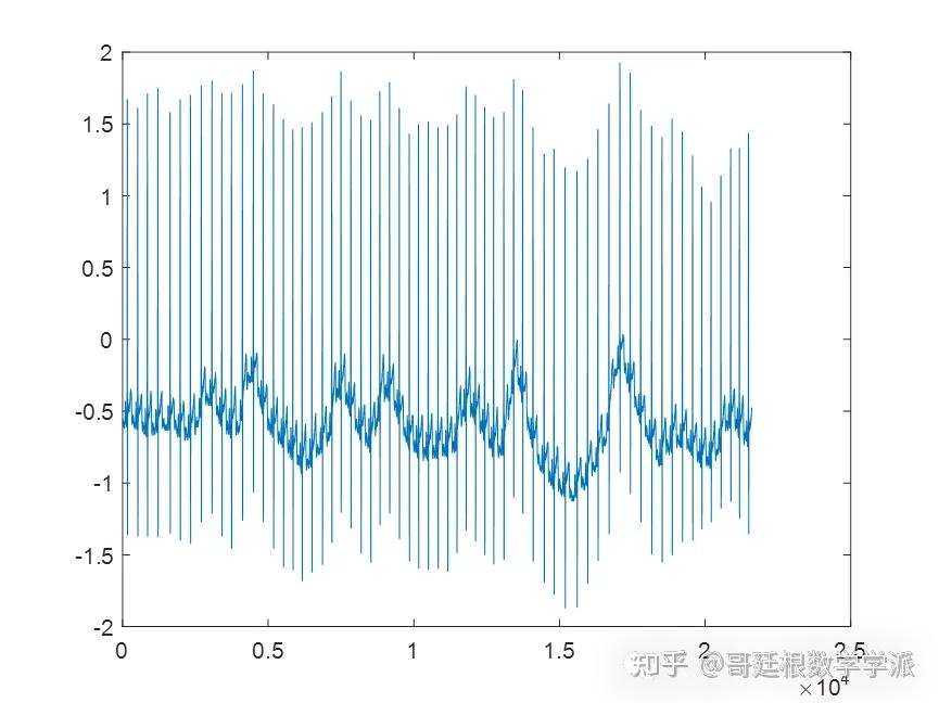心电图v1导联呈rs波,具体的r波代表什么?