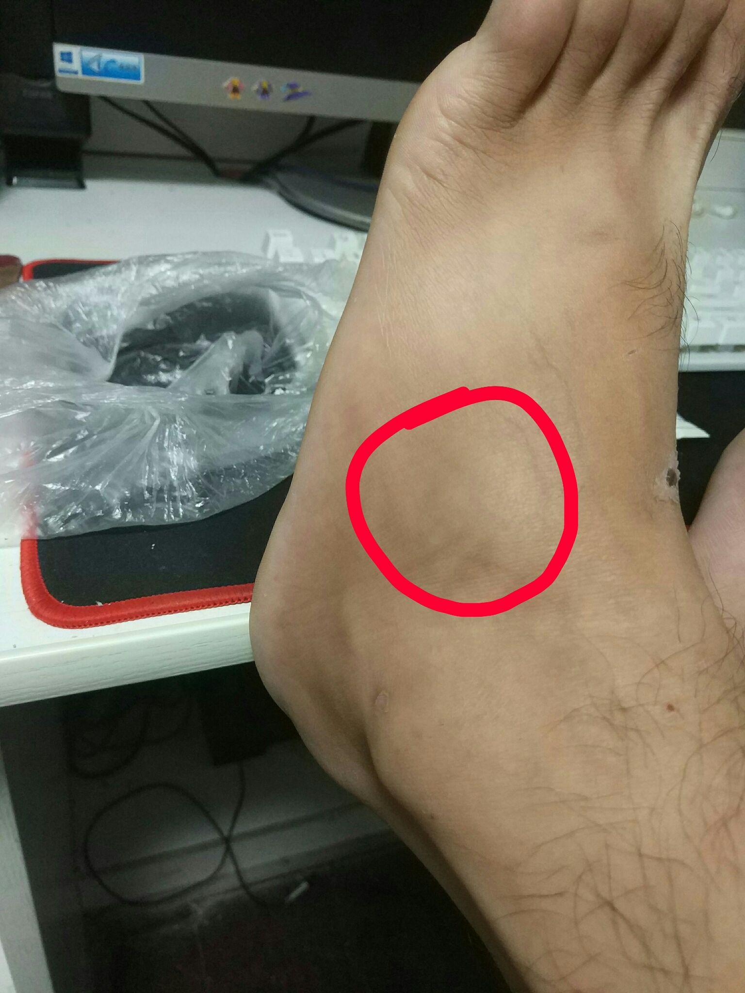 我的脚面经常在睡着的时候跟扭到一样的痛是怎么回事