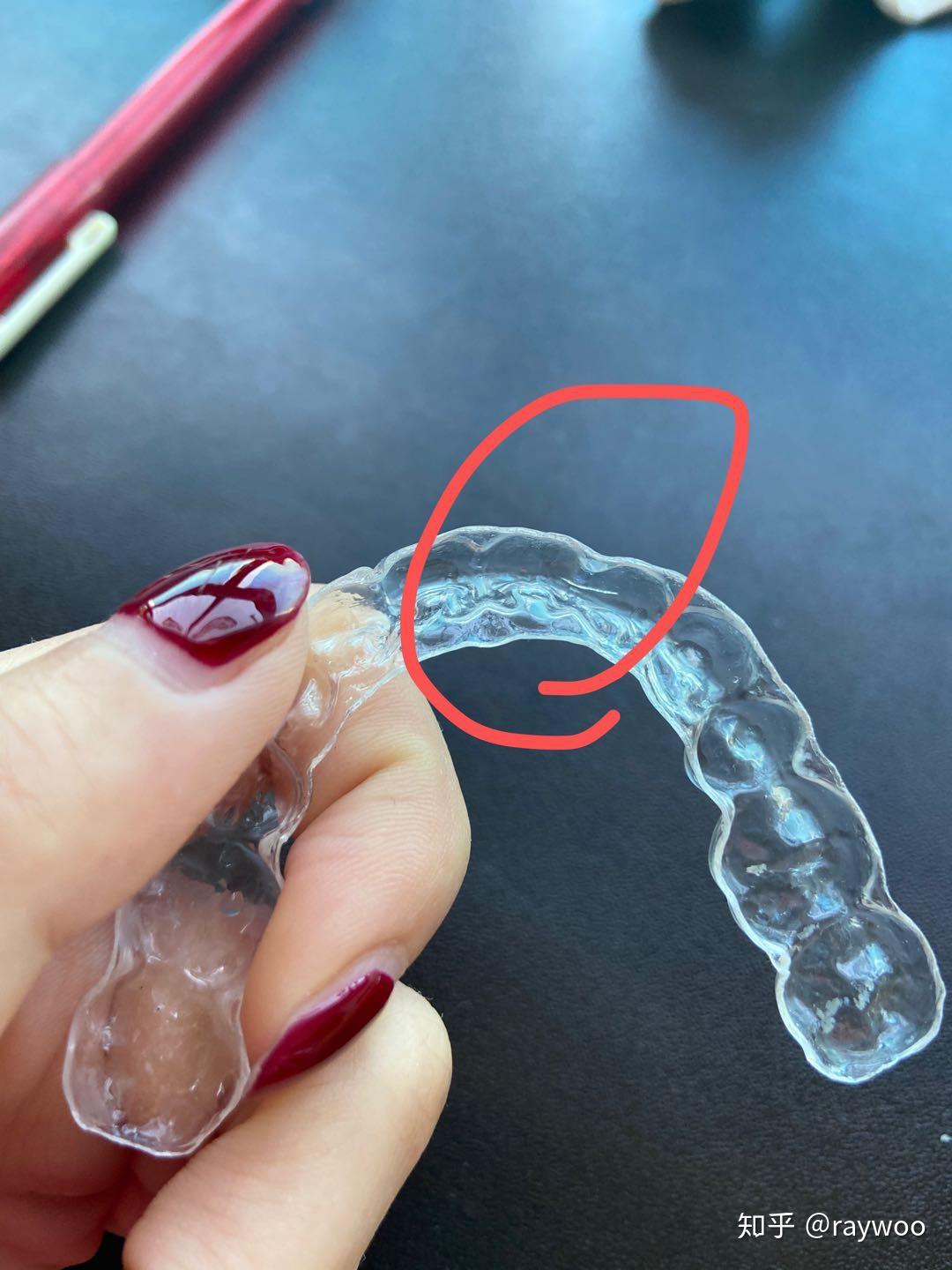 透明保持器戴了一个星期裂了一条小缝隙请问一下还能戴吗?