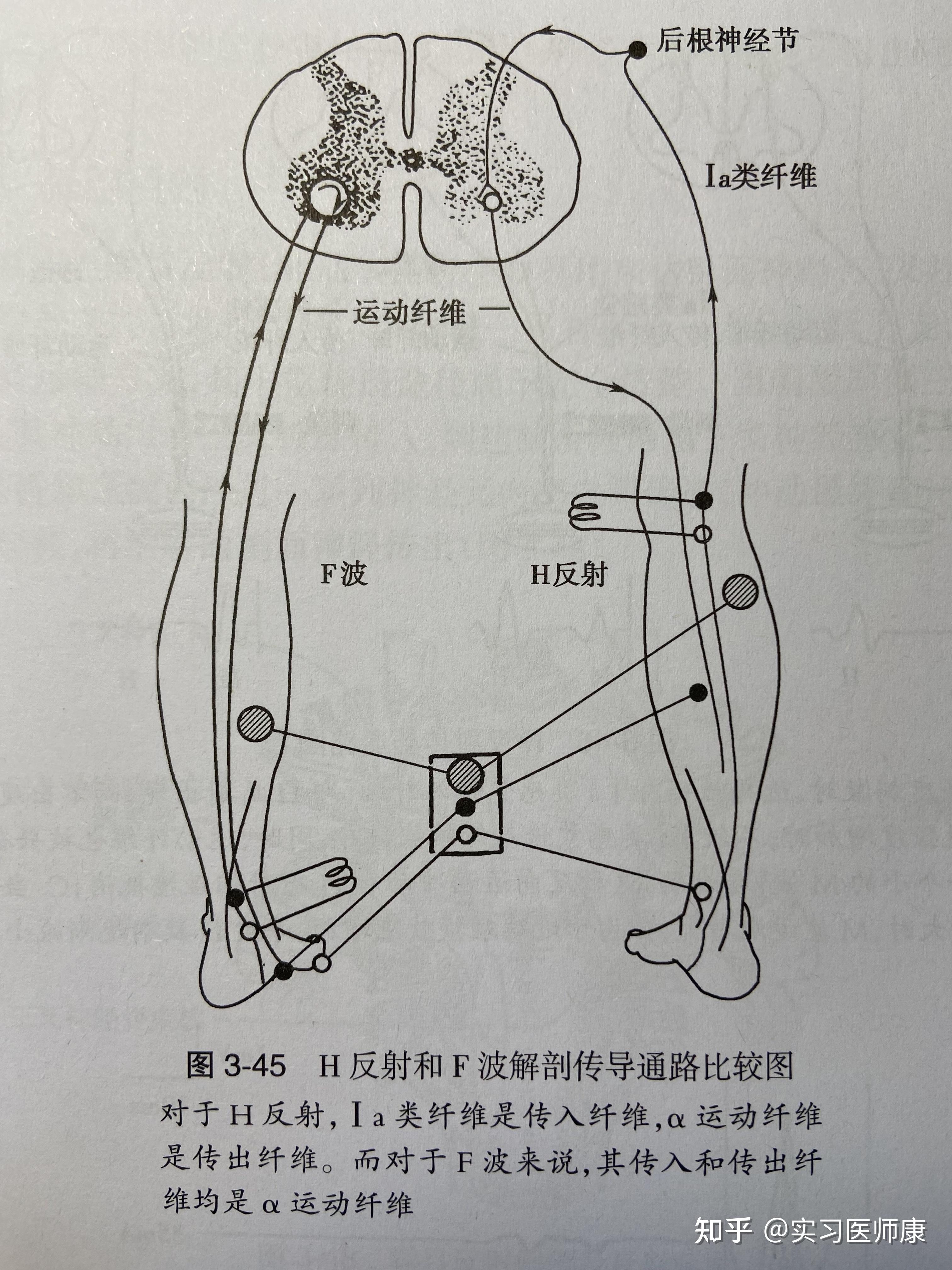 肌电图的h波和m波到底是什么? - 知乎