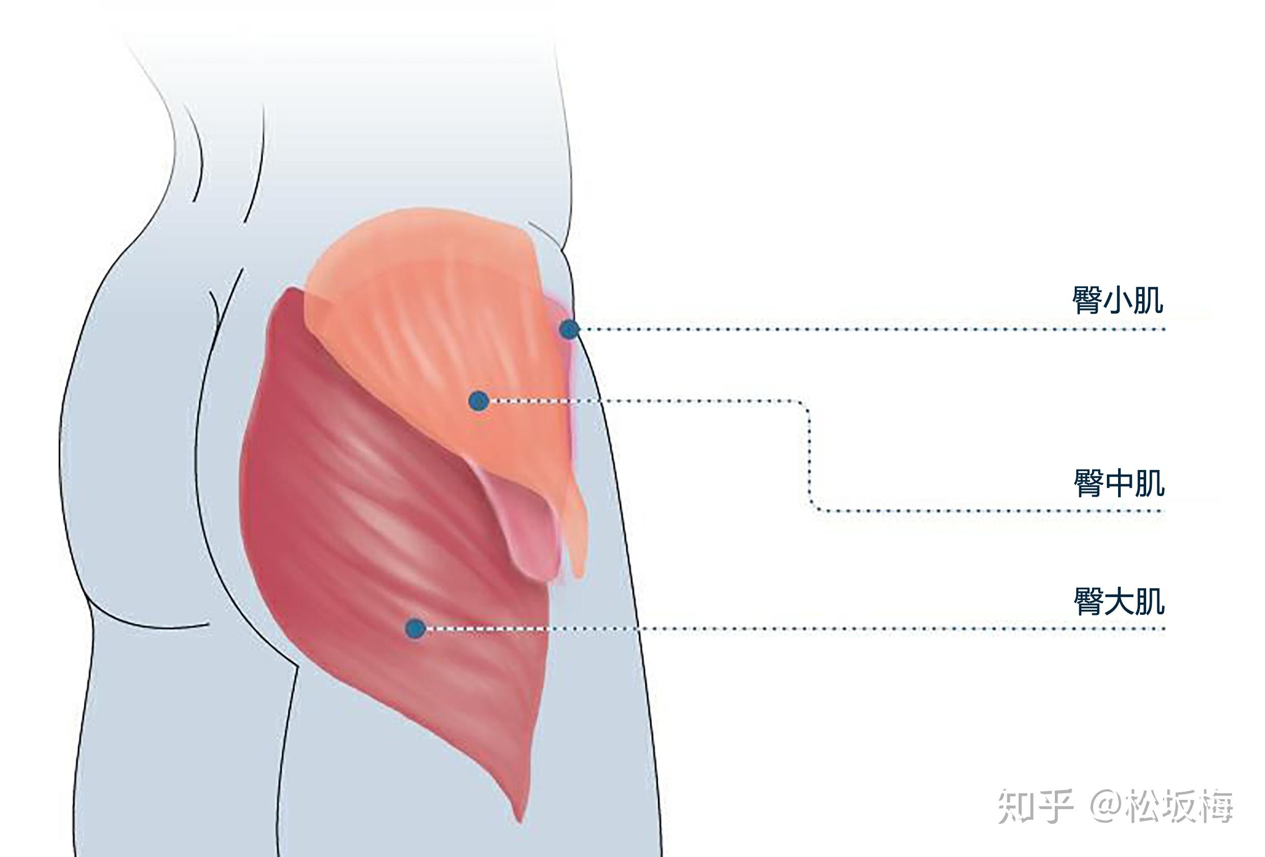 臀部兩側凹陷是因為臀中肌不發達嗎