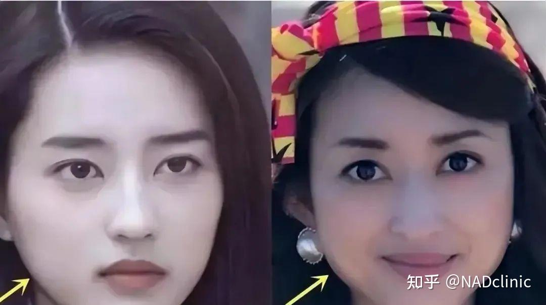 面部发腮应该如何改善? - 知乎