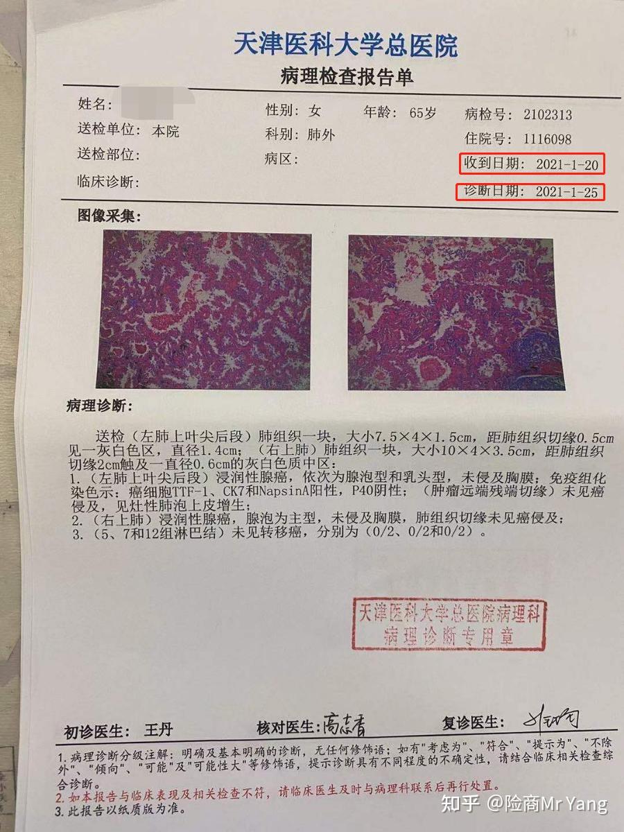 恶性肿瘤重疾理赔是按送检日为准还是出病理报告那天为准