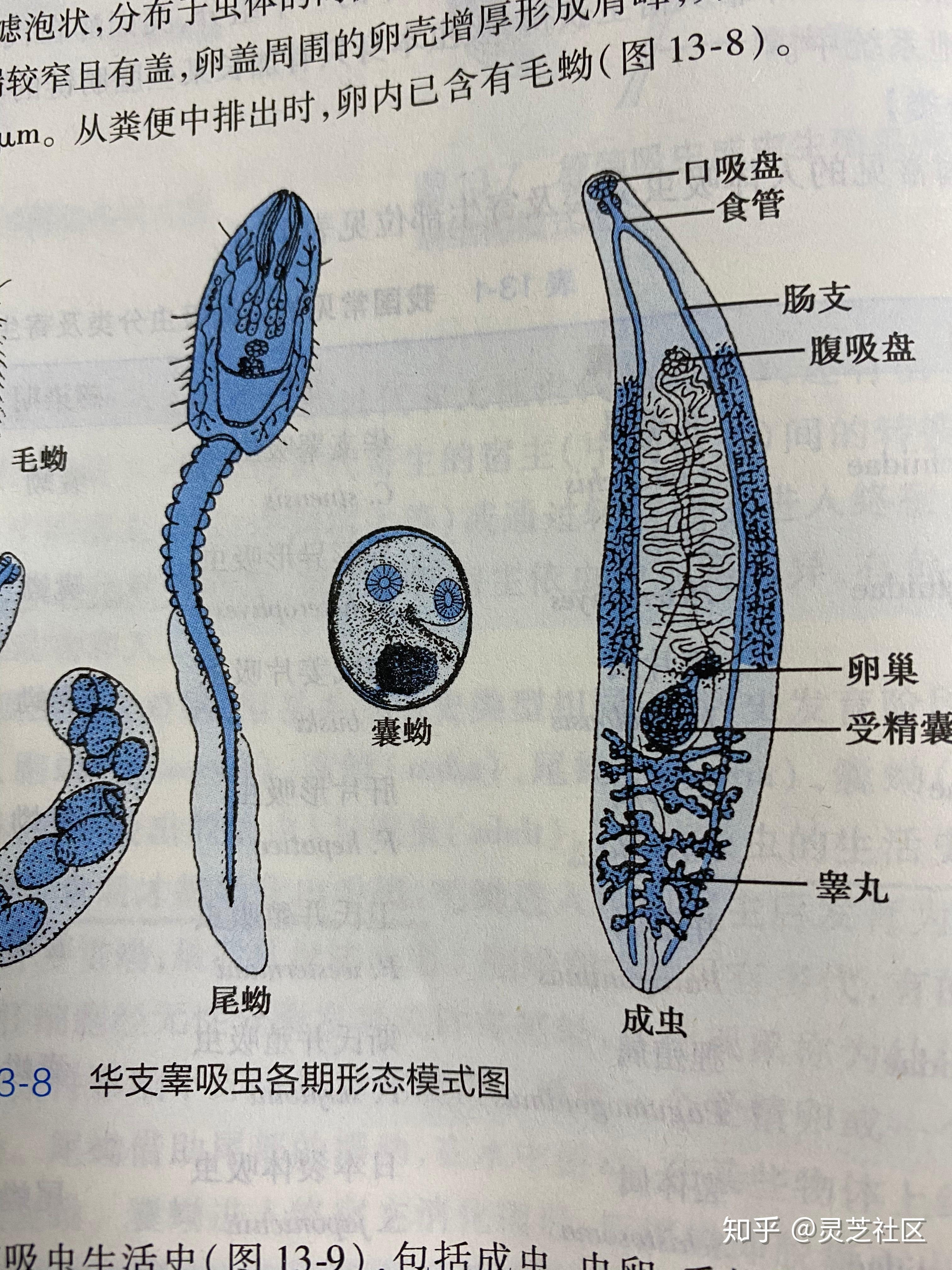 华支睾吸虫结构图片图片